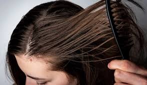 How Can You Control Oily Hair and Scalp Naturally?